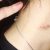 How to Get rid of Hickey Fast TOP 13 Solution? And Different Reason
