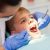 Tooth stain vs cavity What’s the Difference and Solution for it