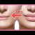 How to Reduce lip Size and Make it Perfect by these Methods